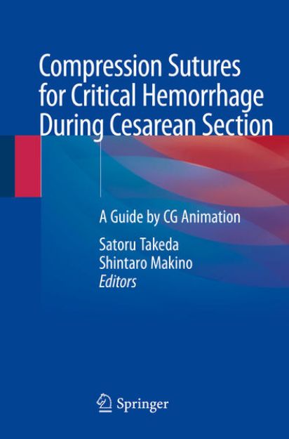 Bild von Compression Sutures for Critical Hemorrhage During Cesarean Section von Satoru (Hrsg.) Takeda