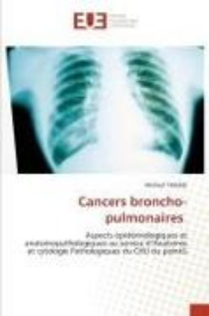 Bild von Cancers broncho-pulmonaires von Michael Tiadjue