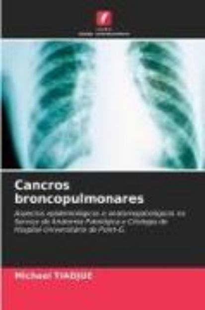 Bild von Cancros broncopulmonares von Michael Tiadjue