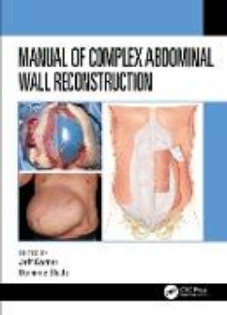 Bild von Manual of Complex Abdominal Wall Reconstruction von Jeff (Hrsg.) Garner