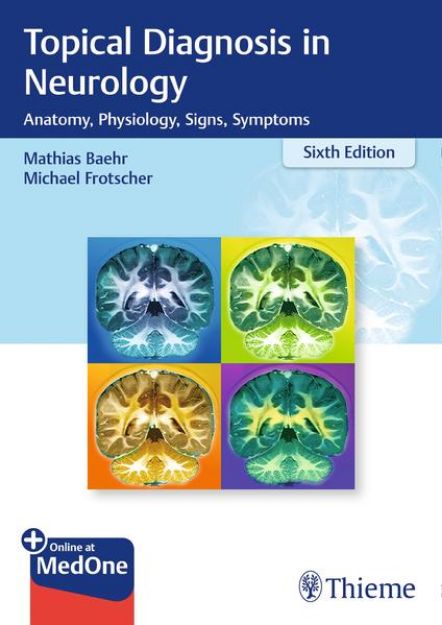 Bild von Topical Diagnosis in Neurology von Mathias Bähr