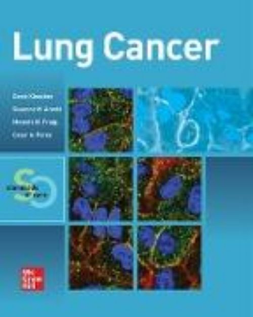 Bild von Lung Cancer: Standards of Care von Goetz Kloecker