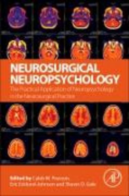 Bild von Neurosurgical Neuropsychology von Caleb M. Pearson (Hrsg.)