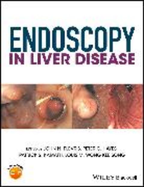 Bild zu Endoscopy in Liver Disease von John N. (Hrsg.) Plevris